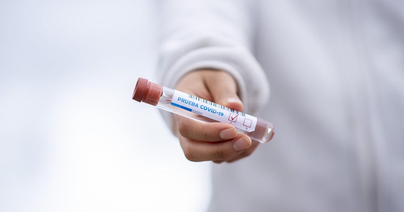 AB test : la méthode simple pour booster vos conversions